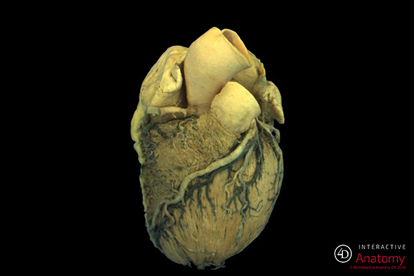 Eyeball 4D Anatomy Model – Exploratorium